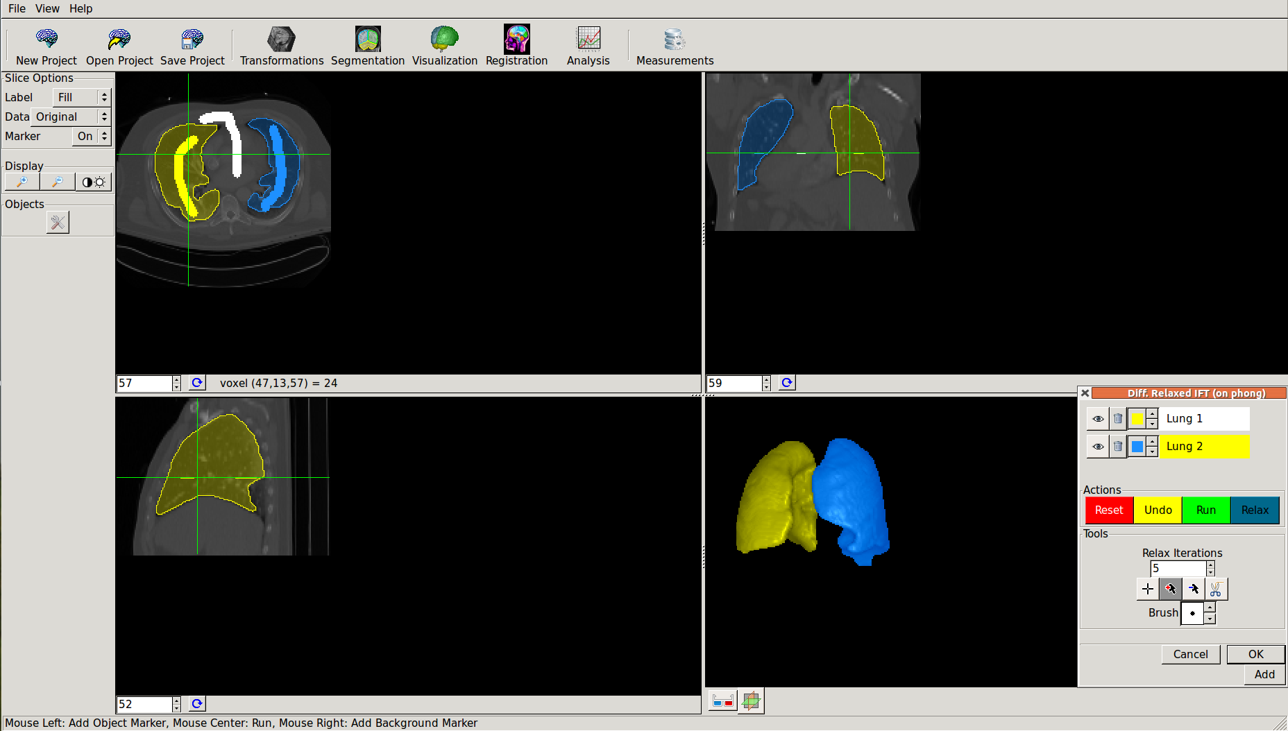 Visva user interface
